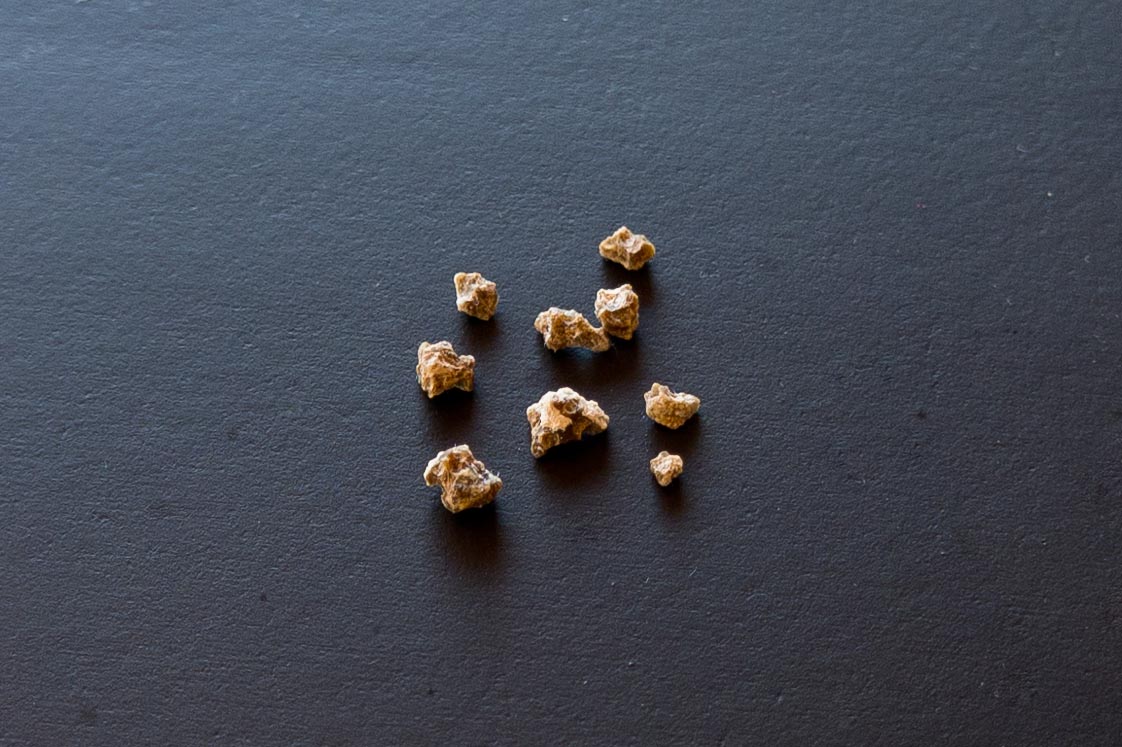 What Are Types Of Kidney Stones