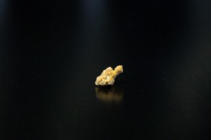Photo of calcium oxalate and calcium phosphate kidney stone
